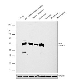 NEFL Monoclonal Antibody (DA2):Antikroppar