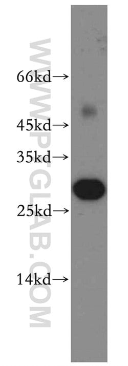 ASPRV1 Rabbit anti-Human, Mouse, Rat, Polyclonal, Proteintech 150 &mu;L;