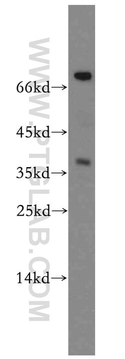ASPRV1 Rabbit anti-Human, Mouse, Rat, Polyclonal, Proteintech 150 &mu;L;