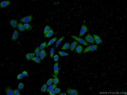 PFDN2 Rabbit anti-Human, Mouse, Polyclonal, Proteintech:Antibodies:Primary