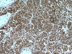 PFDN2 Rabbit anti-Human, Mouse, Polyclonal, Proteintech:Antibodies:Primary
