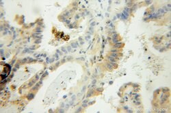 PFDN2 Rabbit anti-Human, Mouse, Polyclonal, Proteintech:Antibodies:Primary