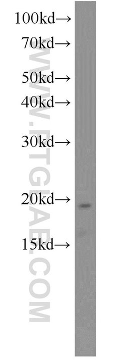 PFDN2 Rabbit anti-Human, Mouse, Polyclonal, Proteintech:Antibodies:Primary