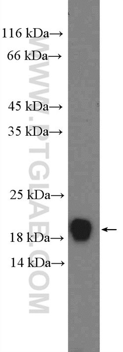 PFDN2 Rabbit anti-Human, Mouse, Polyclonal, Proteintech:Antibodies:Primary