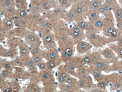 THRSP Rabbit anti-Human, Mouse, Rat, Polyclonal, Proteintech:Antibodies:Primary