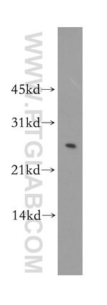Thumbnail_LXN Rabbit anti-Human, Mouse, Rat, Polyclonal, Proteintech 20 &mu;L; Unconjugated:Anticorps,