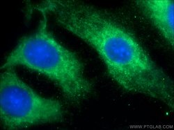MACF1 Rabbit anti-Human, Mouse, Rat, Polyclonal, Proteintech:Antibodies:Primary