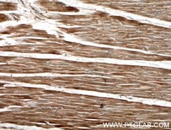 MACF1 Rabbit anti-Human, Mouse, Rat, Polyclonal, Proteintech:Antibodies:Primary
