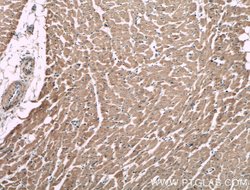 MACF1 Rabbit anti-Human, Mouse, Rat, Polyclonal, Proteintech:Antibodies:Primary