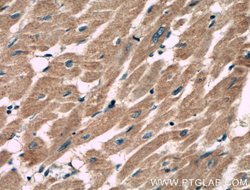 MACF1 Rabbit anti-Human, Mouse, Rat, Polyclonal, Proteintech:Antibodies:Primary