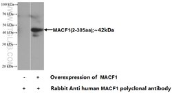 MACF1 Rabbit anti-Human, Mouse, Rat, Polyclonal, Proteintech:Antibodies:Primary