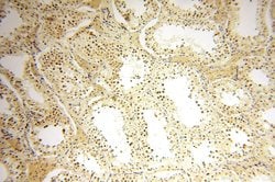 CDK2AP1 Rabbit anti-Human, Polyclonal, Proteintech:Antibodies:Primary Antibodies