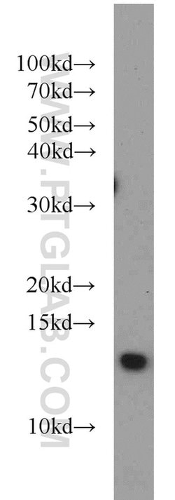 CDK2AP1 Rabbit anti-Human, Polyclonal, Proteintech:Antibodies:Primary Antibodies