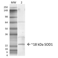 Superoxide dismutase 1 (SOD1) Polyclonal Antibody, QED Bioscience 100 &mu;g;