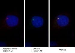 UNC119 Rabbit anti-Canine, Human, Mouse, Rat, Polyclonal, Proteintech:Antibodies:Primary
