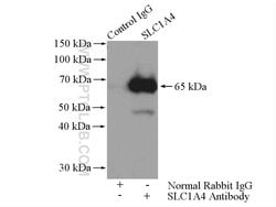 SLC1A4 Rabbit anti-Human, Mouse, Rat, Polyclonal, Proteintech 150 &mu;L;