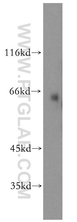SLC1A4 Rabbit anti-Human, Mouse, Rat, Polyclonal, Proteintech 150 &mu;L;