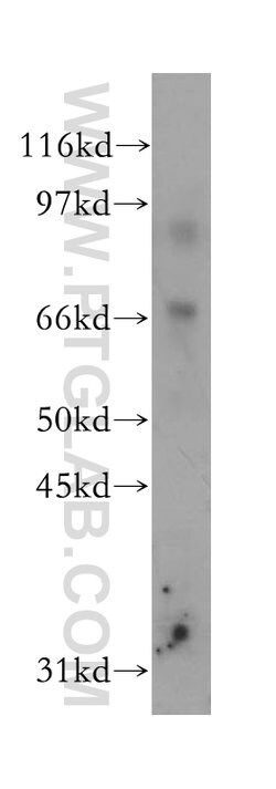 15 Lipoxygenase 2 Rabbit anti-Human, Mouse, Rat, Polyclonal, Proteintech