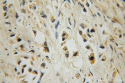 15 Lipoxygenase 2 Rabbit anti-Human, Mouse, Rat, Polyclonal, Proteintech