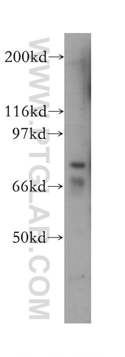15 Lipoxygenase 2 Rabbit anti-Human, Mouse, Rat, Polyclonal, Proteintech