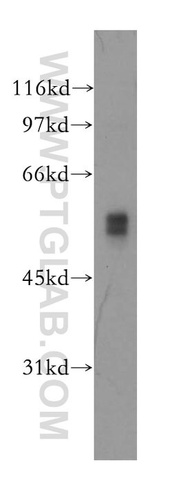 DFNA5 Rabbit anti-Human, Mouse, Polyclonal, Proteintech:Antibodies:Primary
