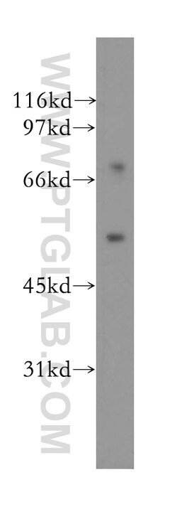 DFNA5 Rabbit anti-Human, Mouse, Polyclonal, Proteintech:Antibodies:Primary