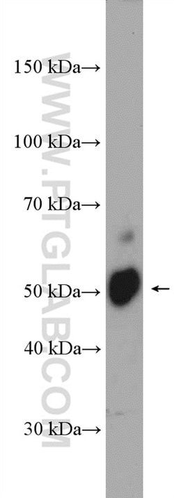DFNA5 Rabbit anti-Human, Mouse, Polyclonal, Proteintech:Antibodies:Primary