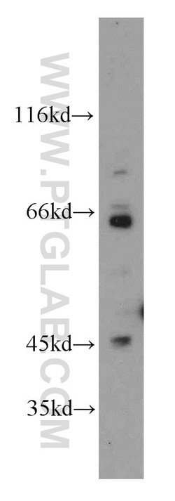 BBS6 Rabbit anti-Human, Mouse, Rat, Polyclonal, Proteintech:Antibodies:Primary