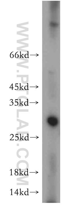 IL-17 Rabbit anti-Human, Polyclonal, Proteintech 150 &mu;L; Unconjugated:Antibodies,