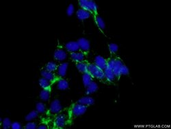 CTNS Rabbit anti-Human, Mouse, Rat, Polyclonal, Proteintech:Antibodies:Primary