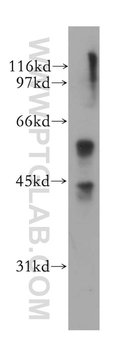 CTNS Rabbit anti-Human, Mouse, Rat, Polyclonal, Proteintech:Antibodies:Primary