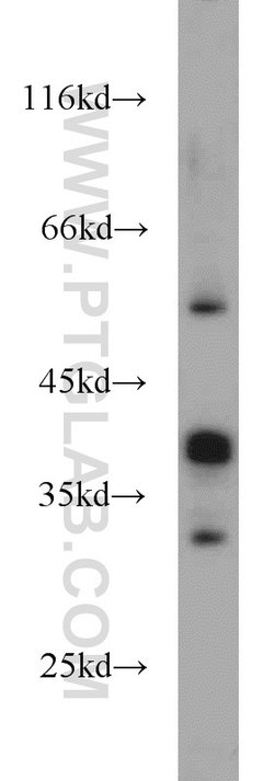 RHOXF2 Rabbit anti-Human, Polyclonal, Proteintech:Antibodies:Primary Antibodies