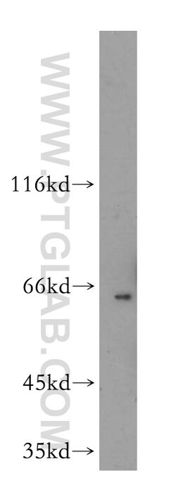 MITF Rabbit anti-Human, Mouse, Rat, Polyclonal, Proteintech:Antibodies:Primary