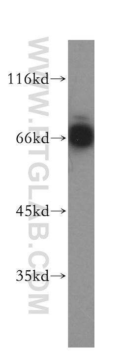 MITF Rabbit anti-Human, Mouse, Rat, Polyclonal, Proteintech:Antibodies:Primary