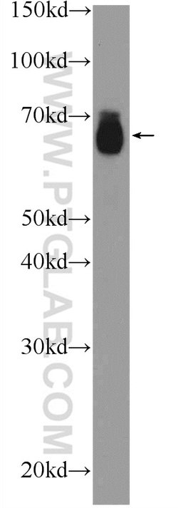 MITF Rabbit anti-Human, Mouse, Rat, Polyclonal, Proteintech:Antibodies:Primary