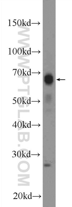 MITF Rabbit anti-Human, Mouse, Rat, Polyclonal, Proteintech:Antibodies:Primary