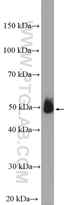 ADRB2 Rabbit anti-Human, Mouse, Rat, Polyclonal, Proteintech 150 &mu;L;