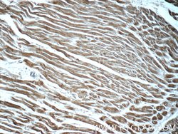 ADRB2 Rabbit anti-Human, Mouse, Rat, Polyclonal, Proteintech 150 &mu;L;