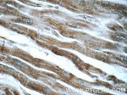 ADRB2 Rabbit anti-Human, Mouse, Rat, Polyclonal, Proteintech 150 &mu;L;