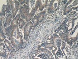 FAS/CD95 Rabbit anti-Human, Polyclonal, Proteintech 150 μL; Unconjugated:Antibodies,