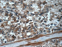 FAS/CD95 Rabbit anti-Human, Polyclonal, Proteintech 150 μL; Unconjugated:Antibodies,