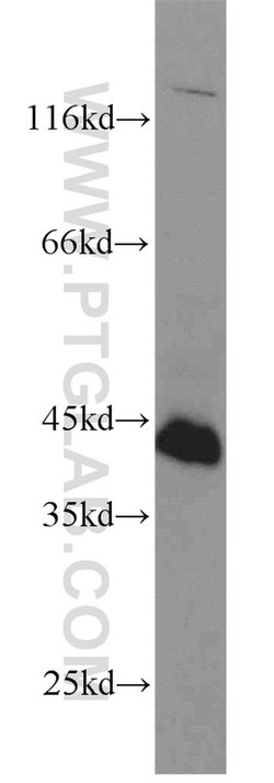 FAS/CD95 Rabbit anti-Human, Polyclonal, Proteintech 150 μL; Unconjugated:Antibodies,