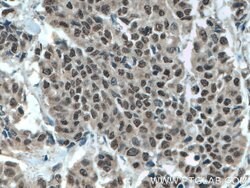 MLF1 Rabbit anti-Human, Mouse, Polyclonal, Proteintech 150 &mu;L; Unconjugated:Antibodies,