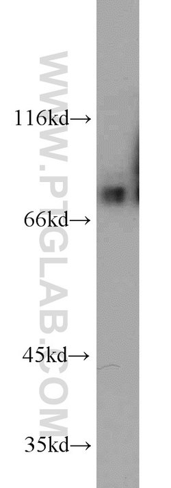DNAJC10 Rabbit anti-Human, Mouse, Rat, Polyclonal, Proteintech:Antikörper:Primärantikörper