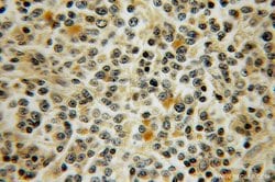 KIF2A Rabbit anti-Canine, Human, Mouse, Rat, Polyclonal, Proteintech 150