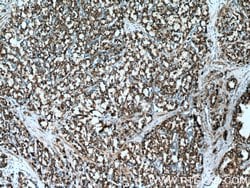 PYCR1 Rabbit anti-Human, Mouse, Rat, Zebrafish, Polyclonal, Proteintech