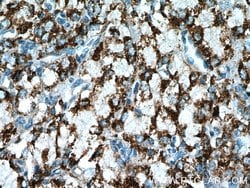 PYCR1 Rabbit anti-Human, Mouse, Rat, Zebrafish, Polyclonal, Proteintech