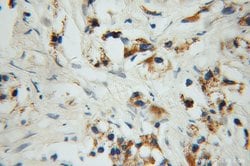 PYCR1 Rabbit anti-Human, Mouse, Rat, Zebrafish, Polyclonal, Proteintech