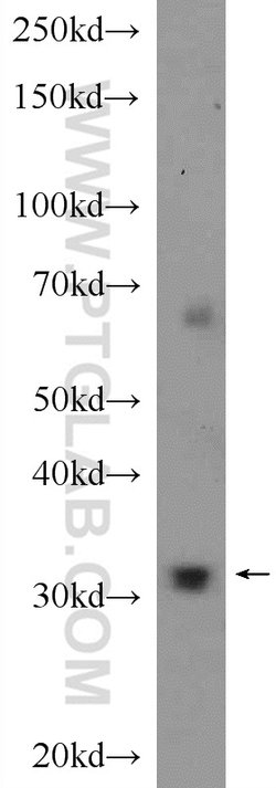 PYCR1 Rabbit anti-Human, Mouse, Rat, Zebrafish, Polyclonal, Proteintech
