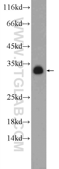 PYCR1 Rabbit anti-Human, Mouse, Rat, Zebrafish, Polyclonal, Proteintech